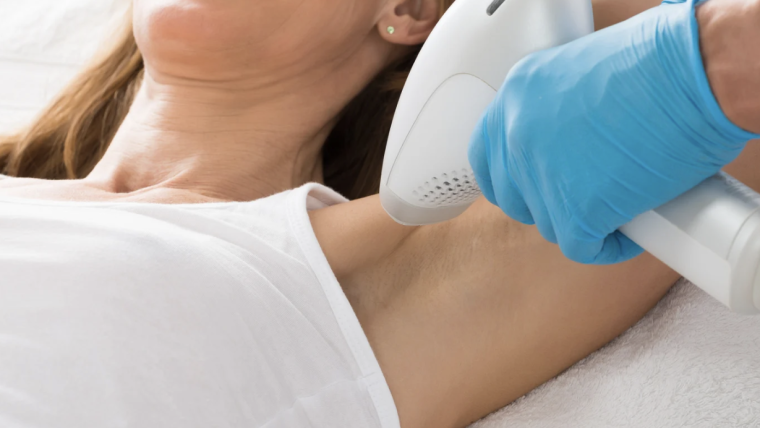 Laser Hair Removal Appointment Near Alexandria, Virginia